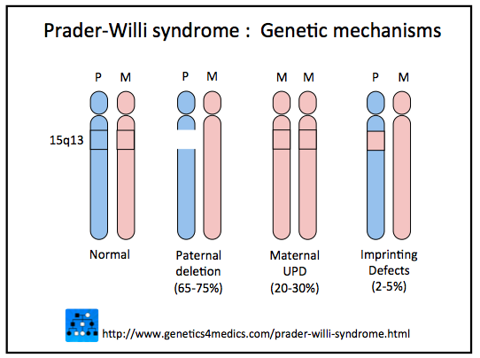 Etiology Prader Willi Syndrome